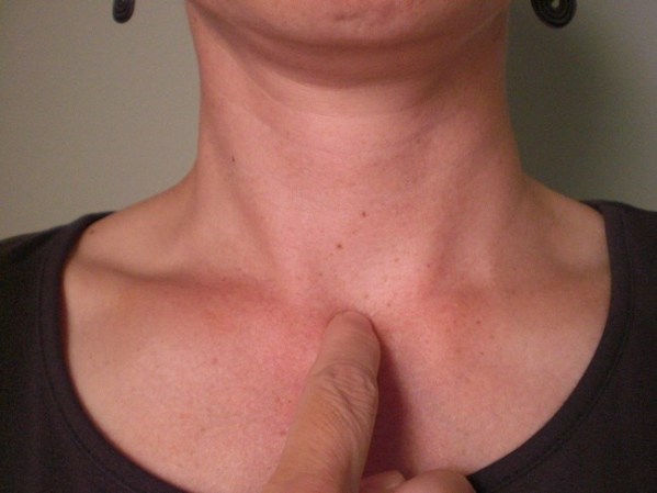 Sternum Trick