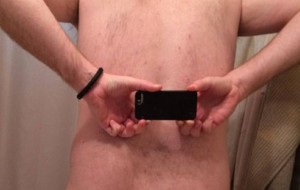 Man with no butt crack opens up about his bizarre - and painful - condition